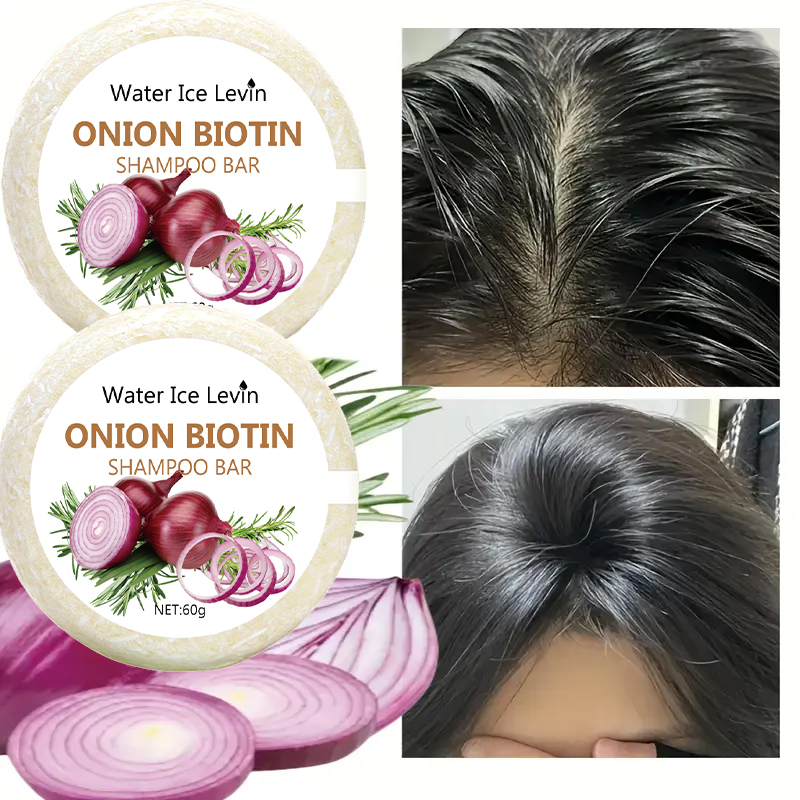 Onion & Biotin Shampoo Bar - 6 - Biotin Hair Growth review and price
